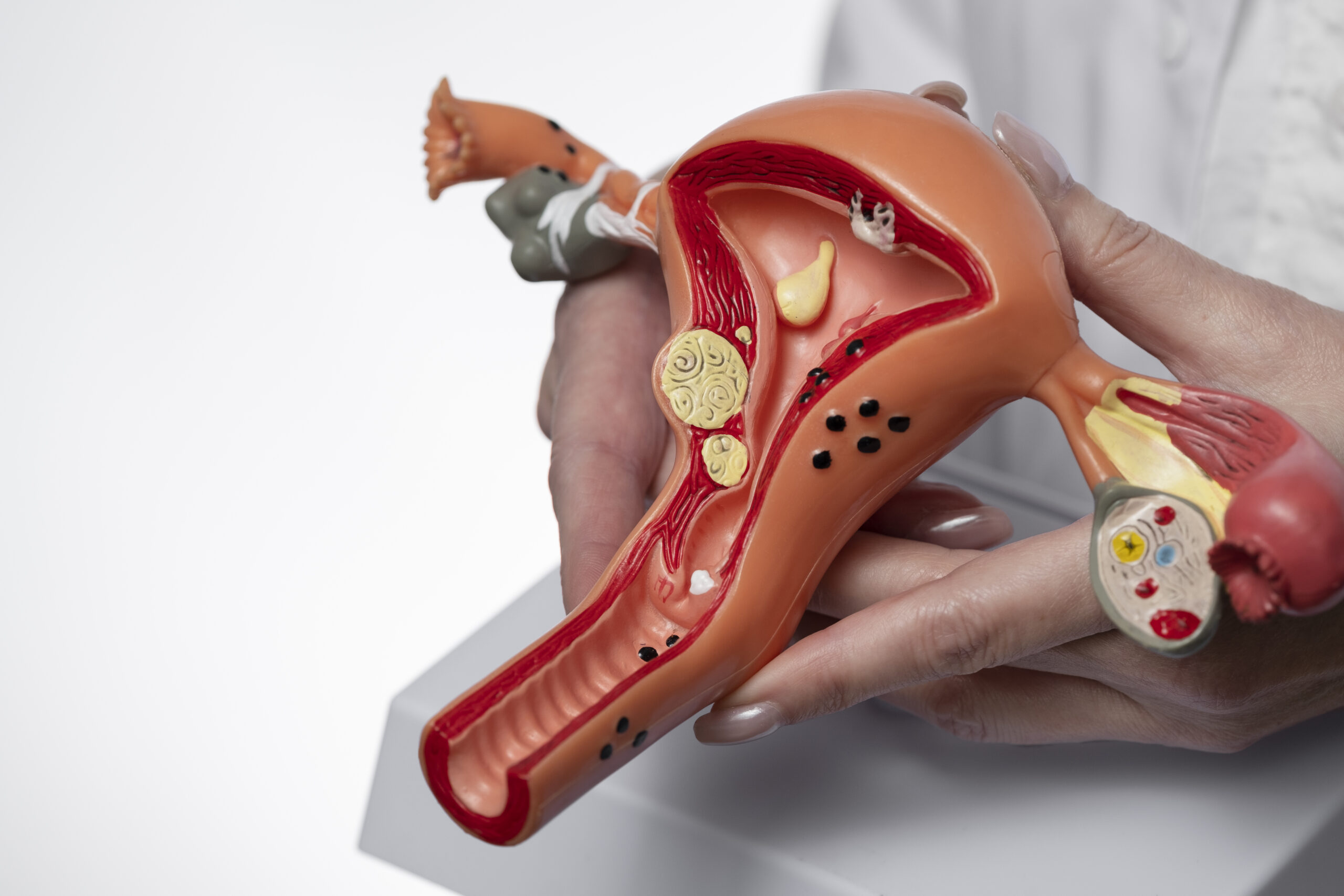hand-holding-uterus-ovary-model